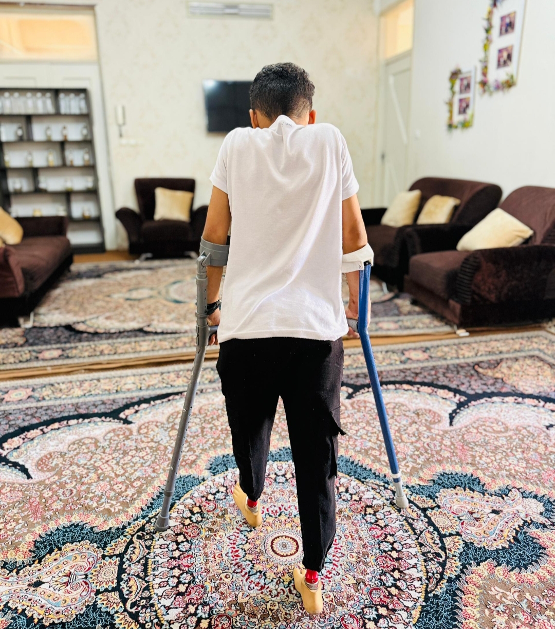 «ایستادن زندگی روی پاهای امید / ابوالفضل عزیز با پاهای جدیدش قدم برمی‌دارد»